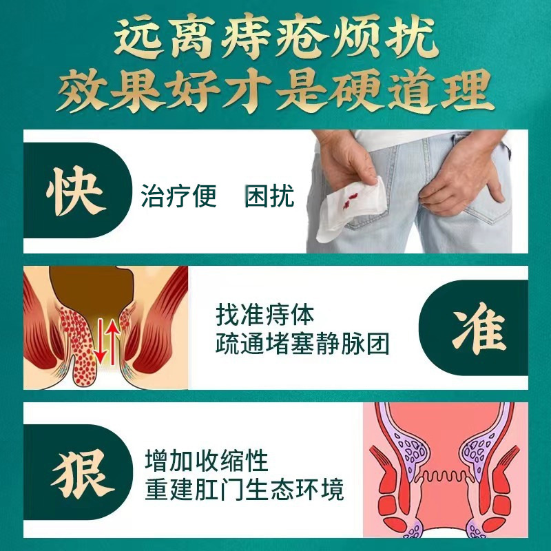 痔瘡膏消肉球痛止癢膏外用瘙癢草本肛部斷痔膏栓混合正品廠家批發(fā)OEM代加工